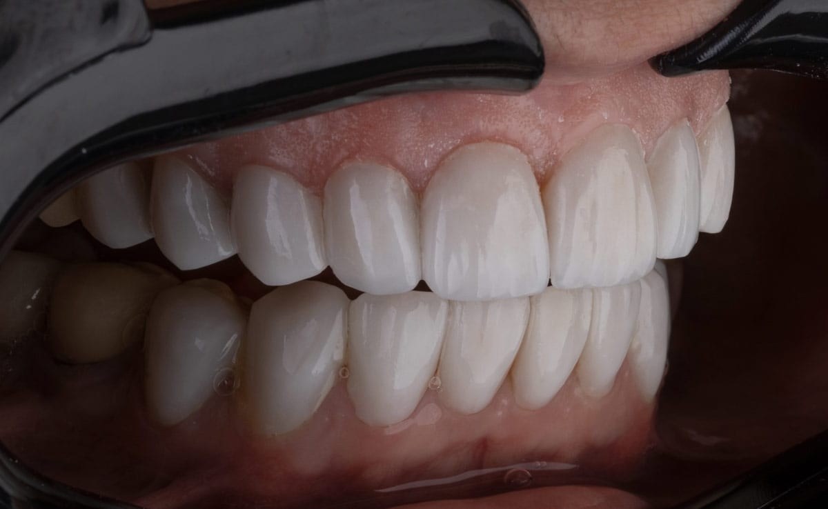 This Japanese Company Is Working On World's First Drug To Grow New Teeth