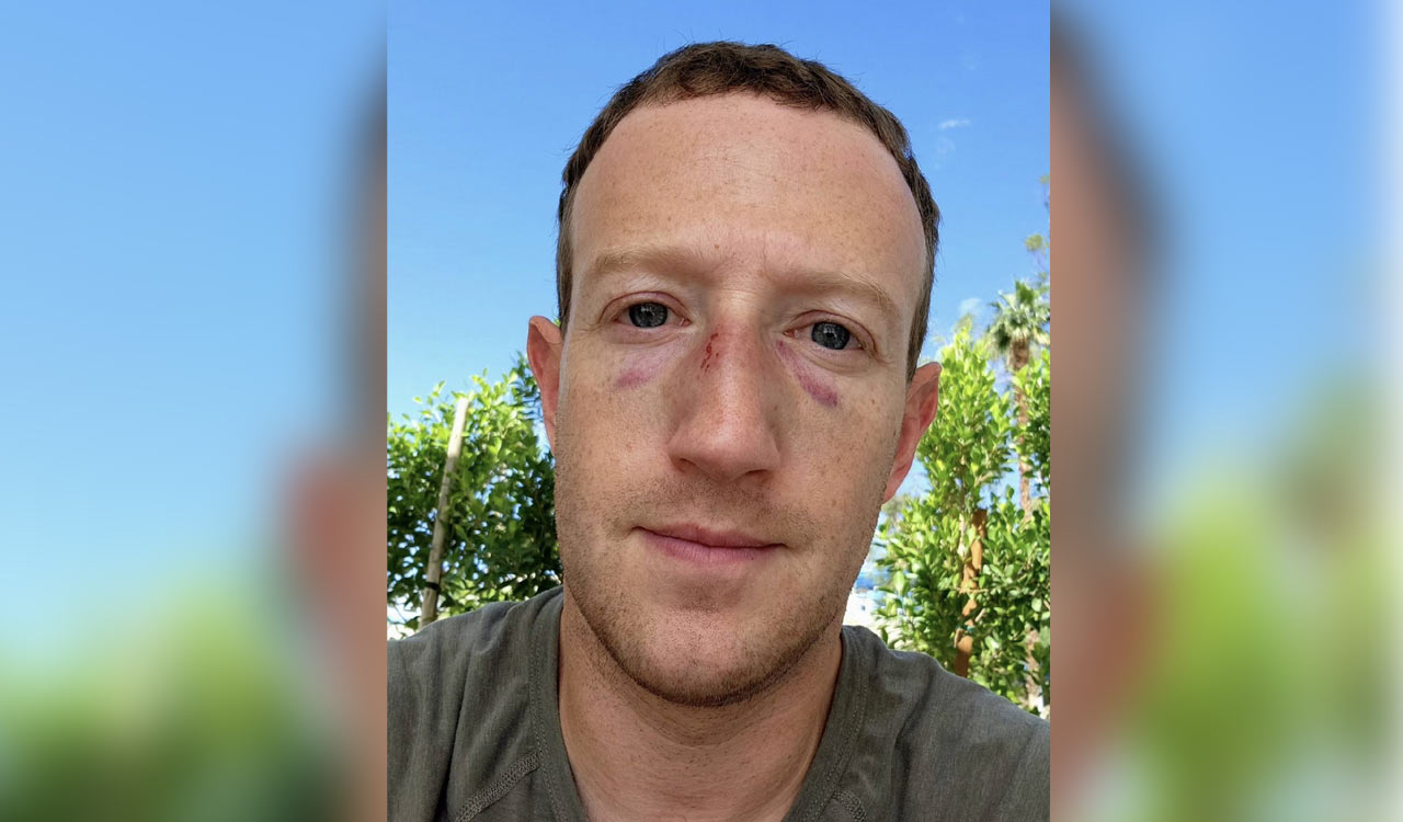 Meta Founder Zuckerberg shares selfie with swelling, bruises on his face