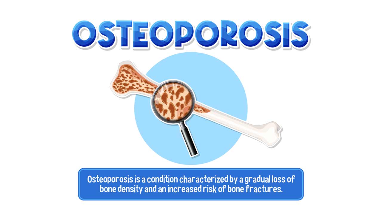 India ranks number one in Osteoporosis cases