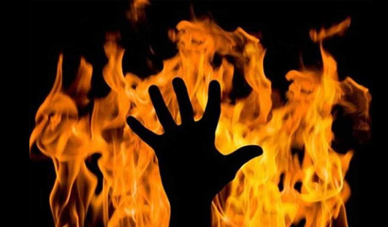 Man sets sister-in-law on fire in MP; held