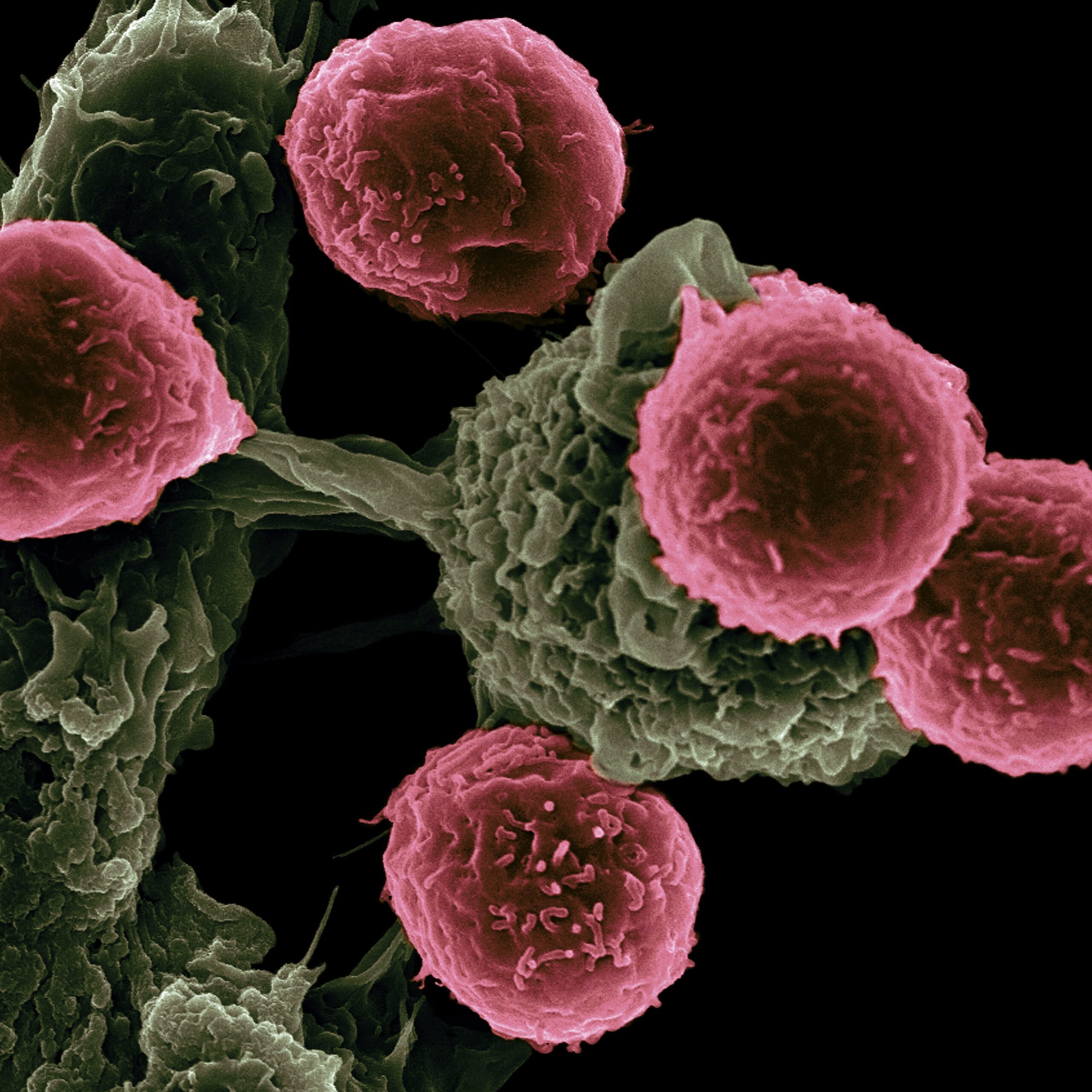 Vibrating Molecules in Lab Experiment Wipe Out 99% Of Cancer Cells