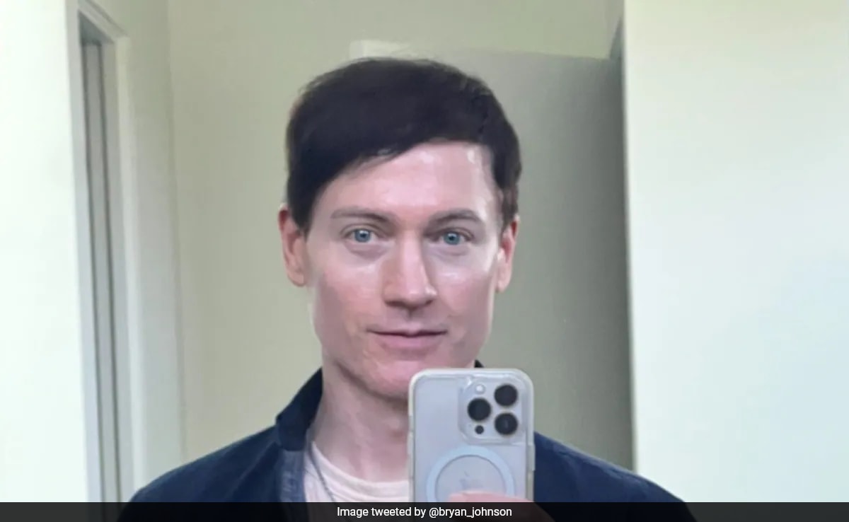 Tech Mogul Who Spends 2 Million A Year To Stay Young Shows Off His New "Baby" Face. See Post