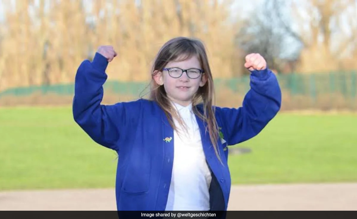 Meet "Bionic Teen" From UK Who Feels No Pain, Hunger Or Fatigue