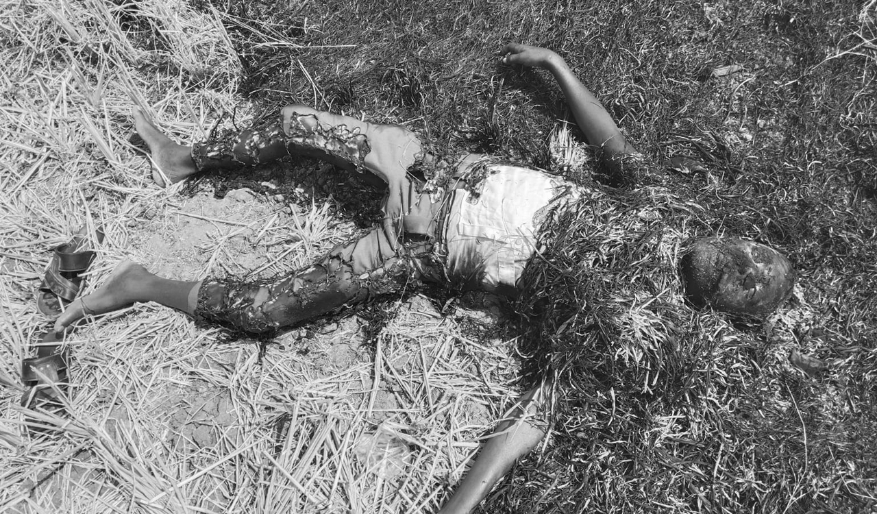 Unidentified man murdered, set on fire in Siddipet