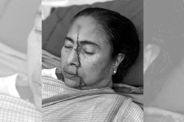 West Bengal CM Mamata Banerjee suffers major head injury; admitted to hospital