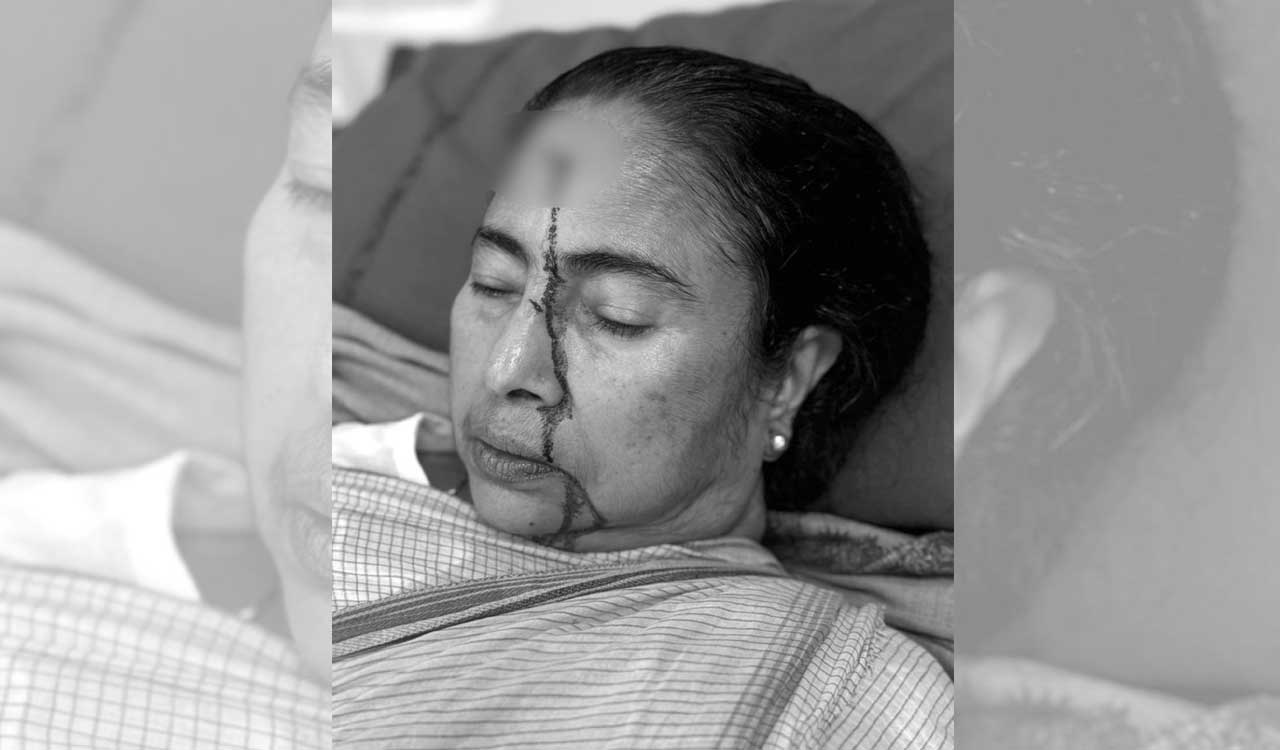 West Bengal CM Mamata Banerjee suffers major head injury; admitted to hospital