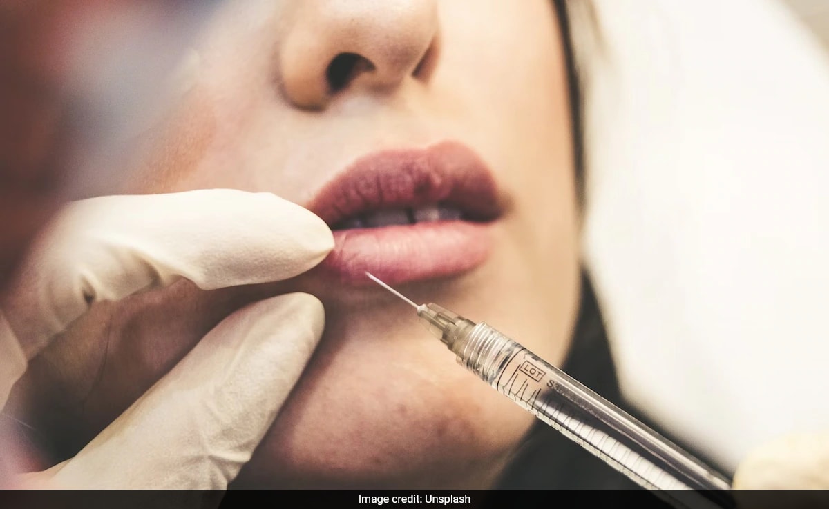 UK Woman, 24, Left "Gasping For Air" After Getting Lip Filler Dissolved