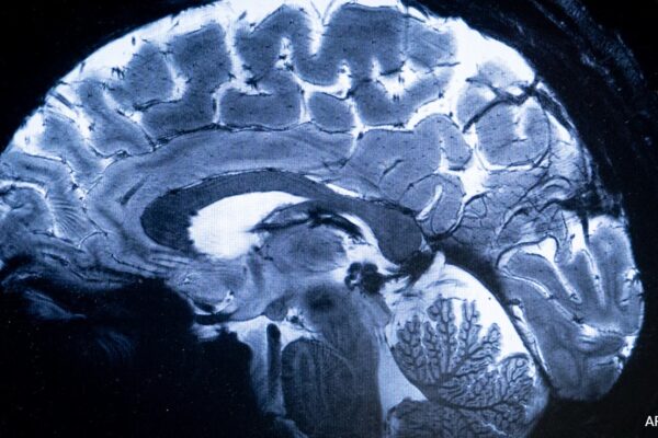 World's Most Powerful MRI Scans 1st Images Of Human Brain