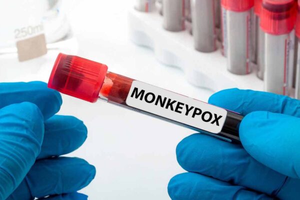 Monkeypox kills 610 in Congo, Says Health Minister Roger Kamba