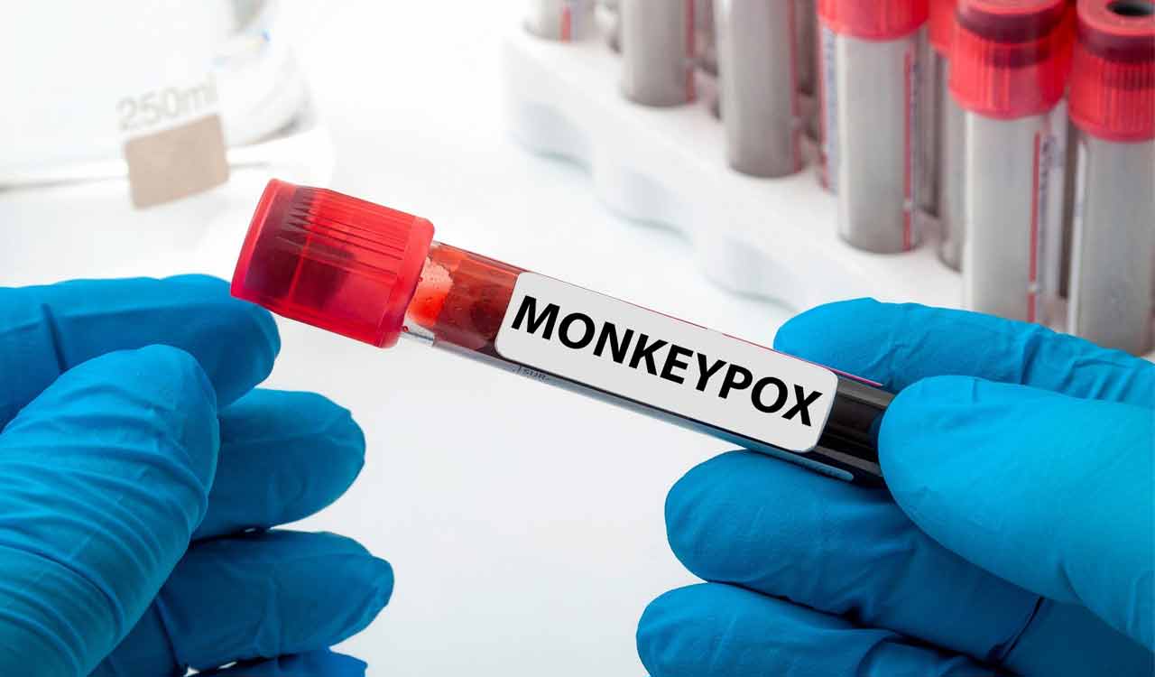 Monkeypox kills 610 in Congo, Says Health Minister Roger Kamba