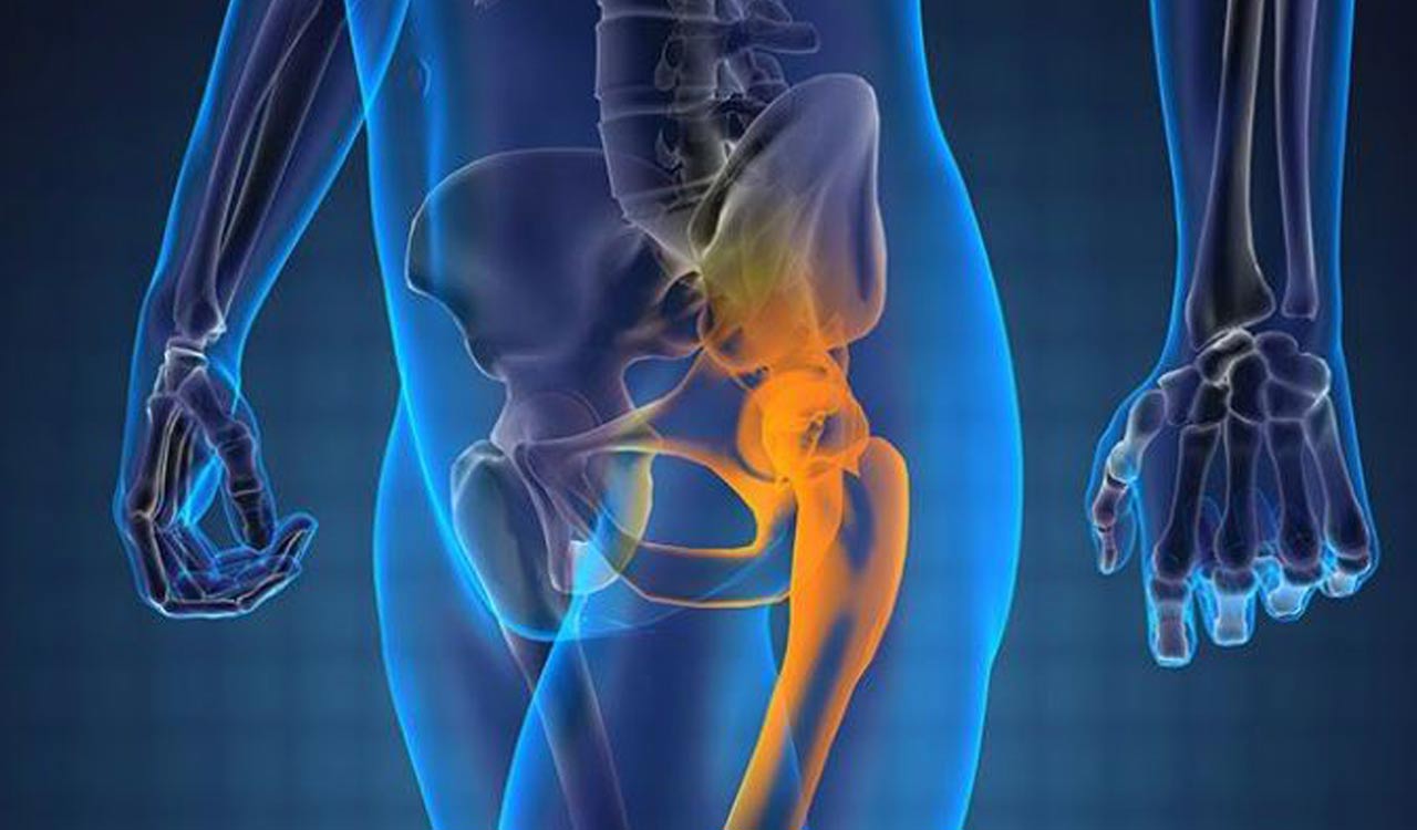 Hyderabad faces surge in advanced-stage prostate cancer cases