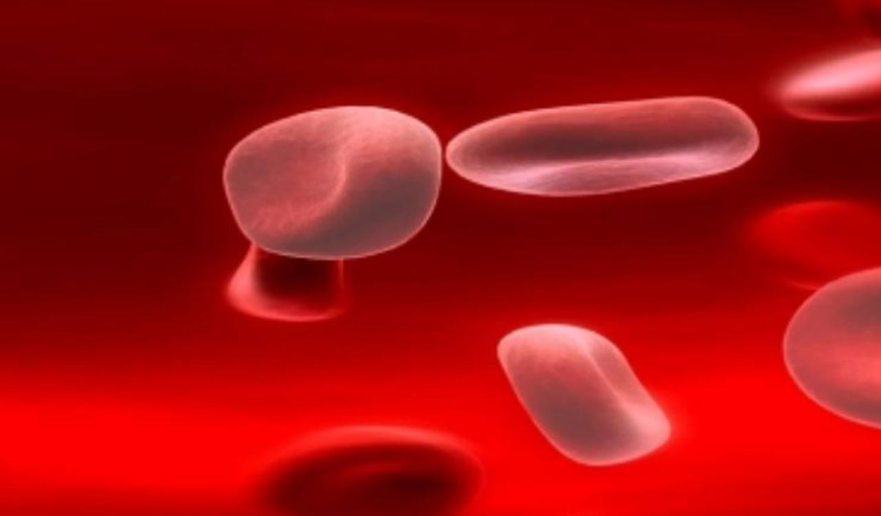 Early iron therapy cuts childhood anaemia by nearly 80 per cent, finds NIN study